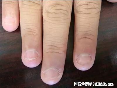 剪指甲、挖耳屎，这些日常小动作竟隐藏大危害！ - 喀什生活资讯 - 喀什28生活网 ks.28life.net